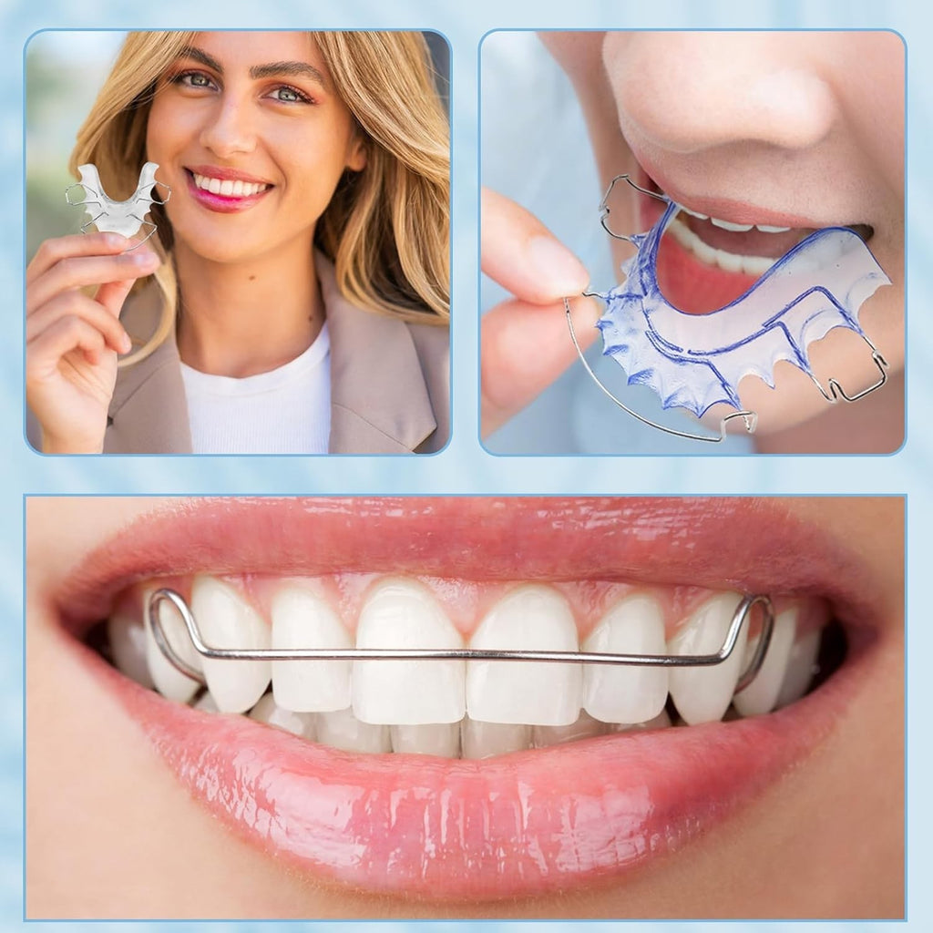 Custom Fit Hawley Retainer after Braces, Durable Dental Retainer, Upper & Low...